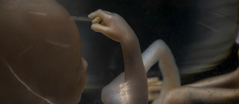 Wonderhormoon of horrorhormoon